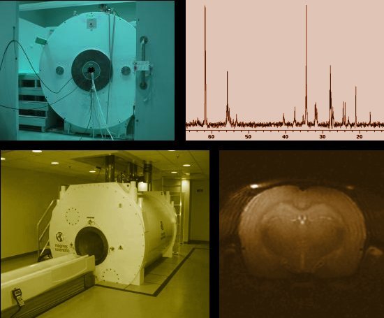 Image of MR scanners and a spectra.